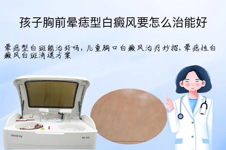 孩子胸前晕痣型白癜风要怎么治能好