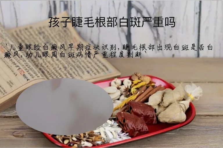 孩子睫毛根部白斑严重吗