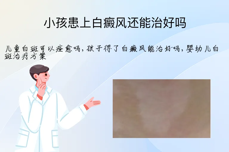 小孩患上白癜风还能治好吗