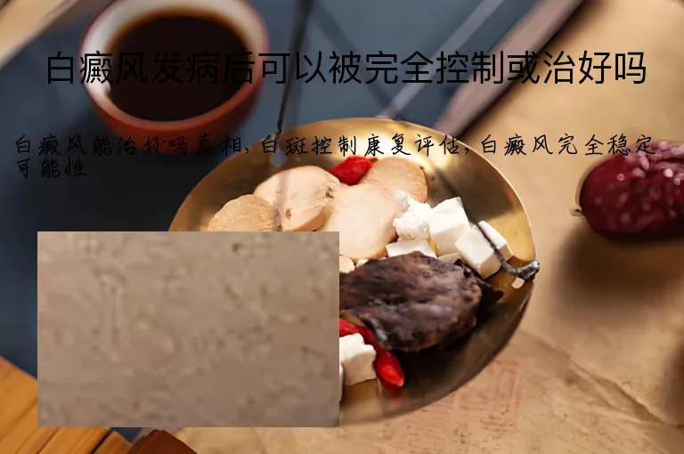 白癜风发病后可以被完全控制或治好吗