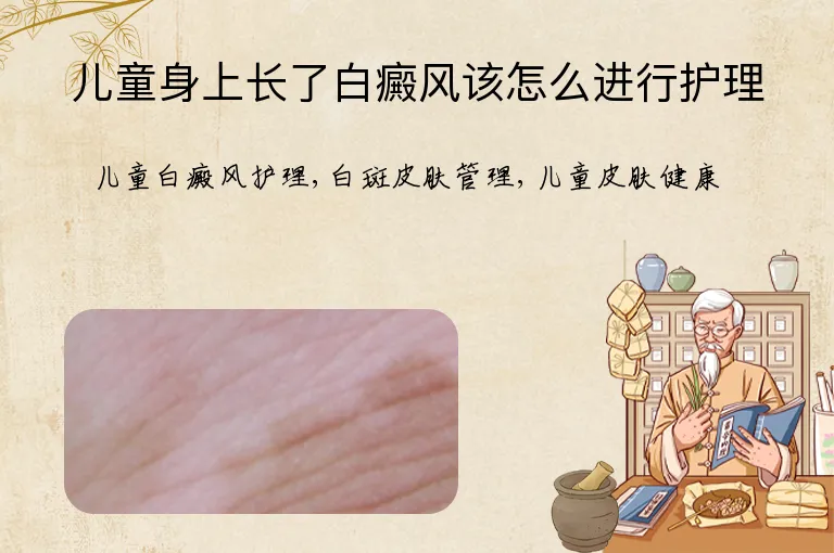 儿童身上长了白癜风该怎么进行护理