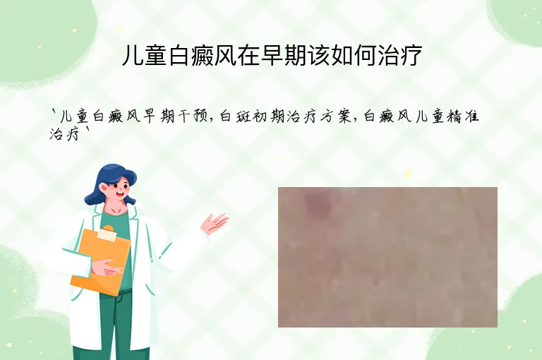 儿童白癜风在早期该如何治疗