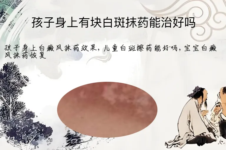 孩子身上有块白斑抹药能治好吗