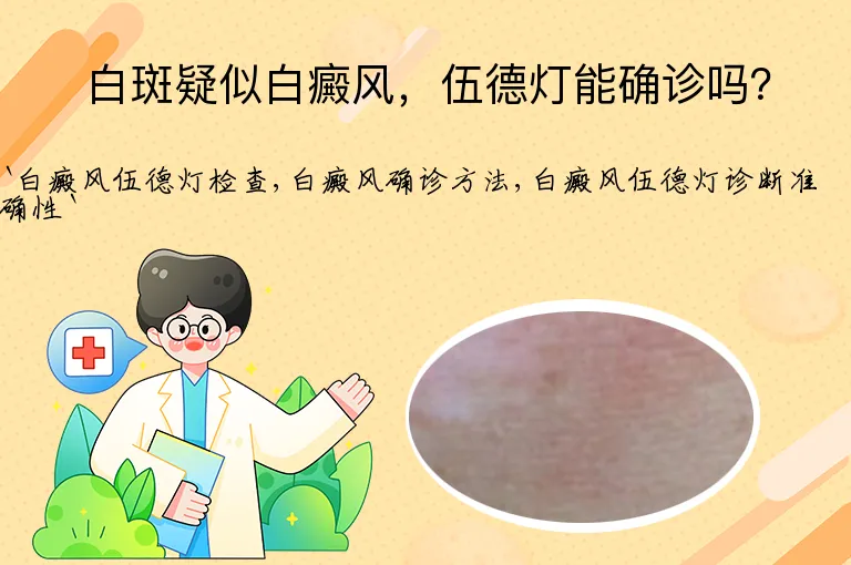 白斑疑似白癜风，伍德灯能确诊吗？