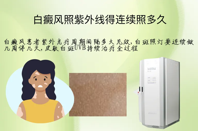 白癜风照紫外线得连续照多久