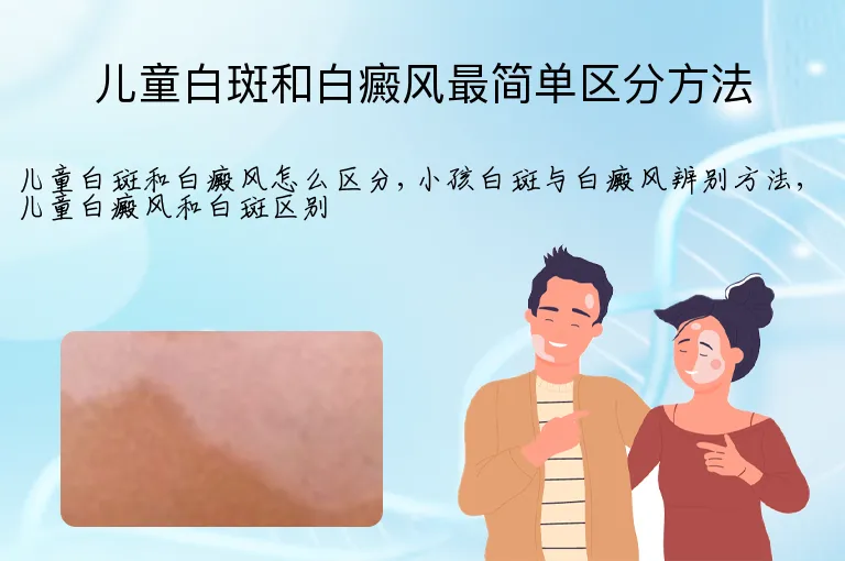 儿童白斑和白癜风最简单区分方法