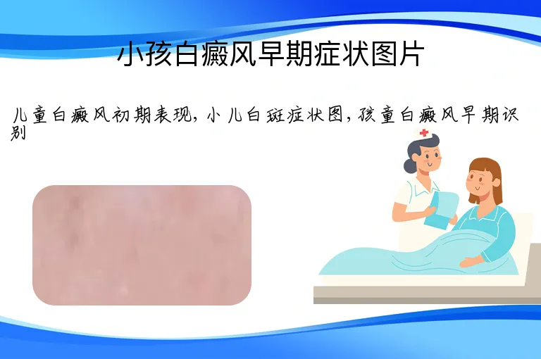 小孩白癜风早期症状图片