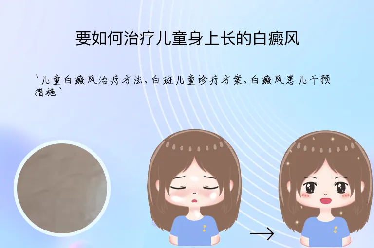 要如何治疗儿童身上长的白癜风