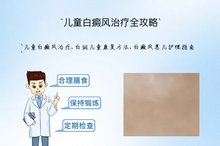 `儿童白癜风治疗全攻略`