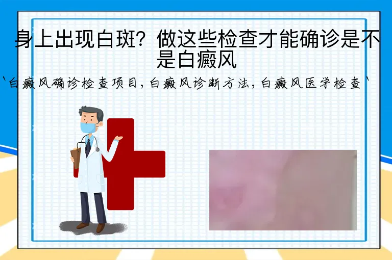 身上出现白斑?做这些检查才能确诊是不是白癜风