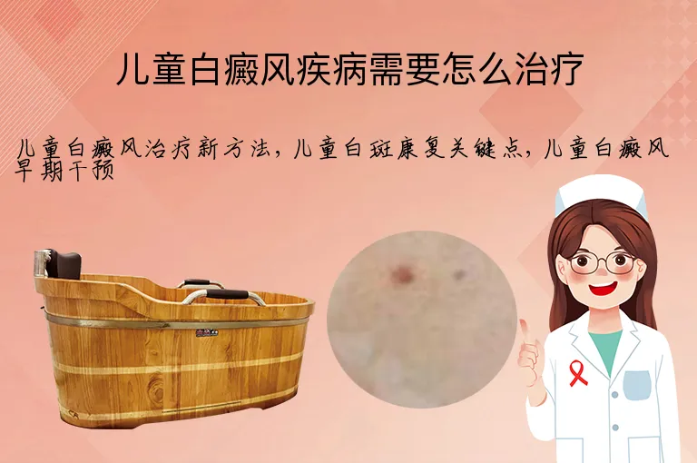 儿童白癜风疾病需要怎么治疗