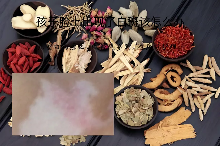 孩子脸上出现了白斑该怎么办