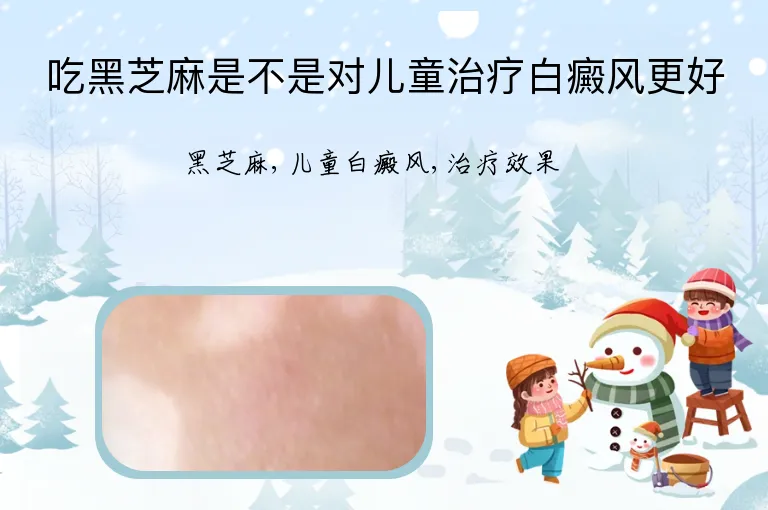 吃黑芝麻是不是对儿童治疗白癜风更好