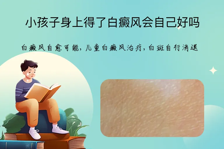 小孩子身上得了白癜风会自己好吗