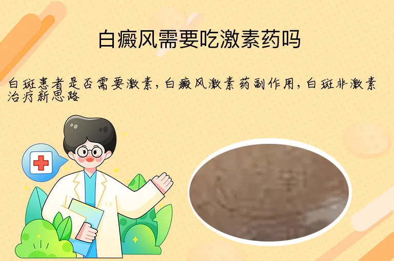 白癜风需要吃激素药吗