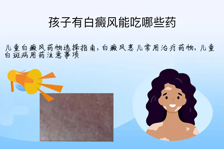 孩子有白癜风能吃哪些药