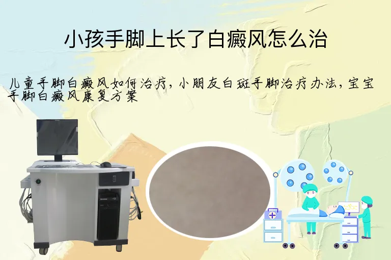 小孩手脚上长了白癜风怎么治