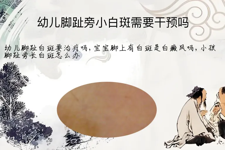 幼儿脚趾旁小白斑需要干预吗