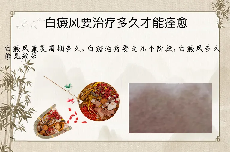 白癜风要治疗多久才能痊愈