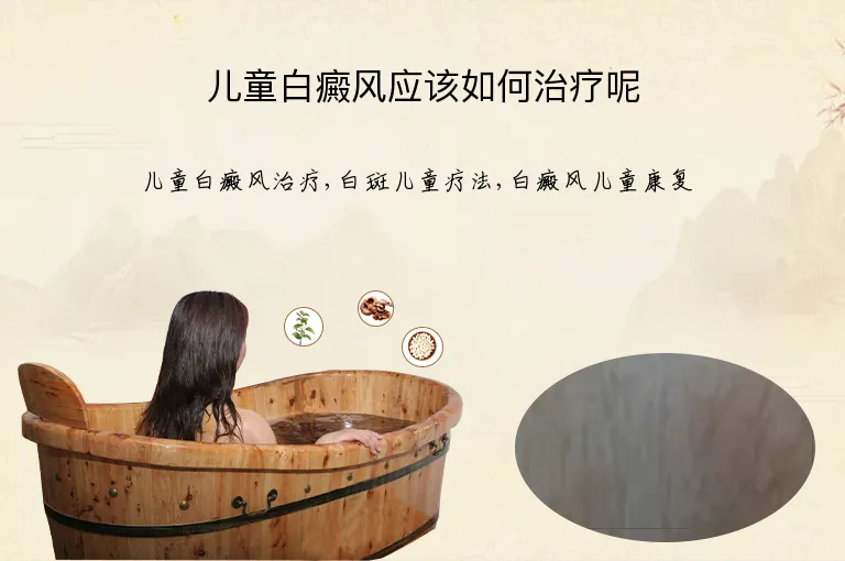 儿童白癜风应该如何治疗呢