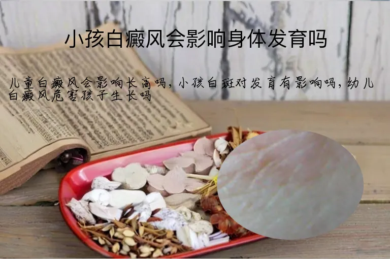 小孩白癜风会影响身体发育吗