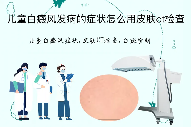 儿童白癜风发病的症状怎么用皮肤ct检查