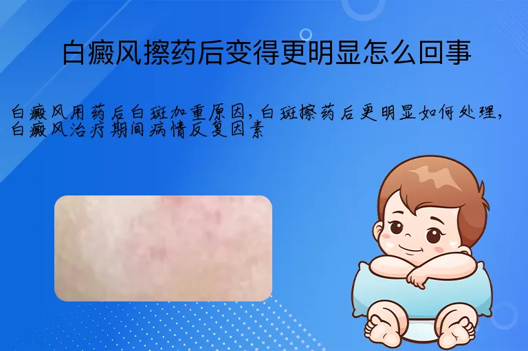 白癜风擦药后变得更明显怎么回事