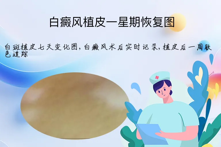 白癜风植皮一星期恢复图