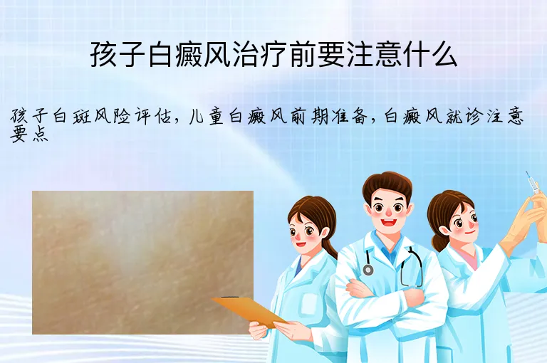 孩子白癜风治疗前要注意什么