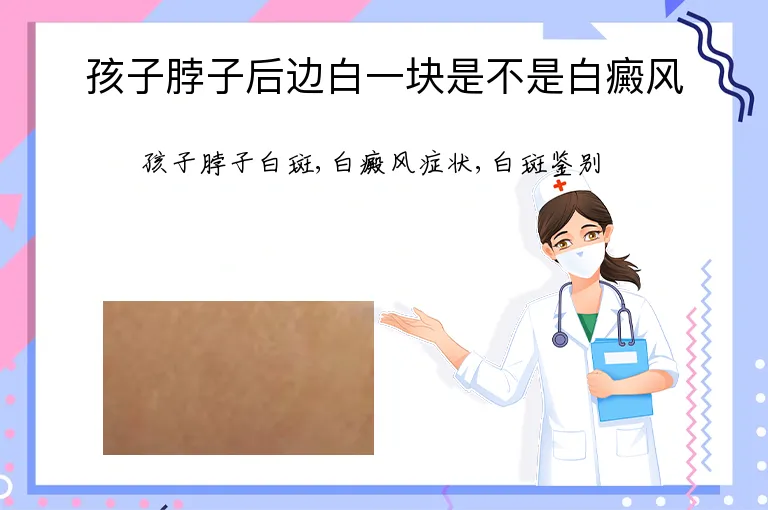 孩子脖子后边白一块是不是白癜风