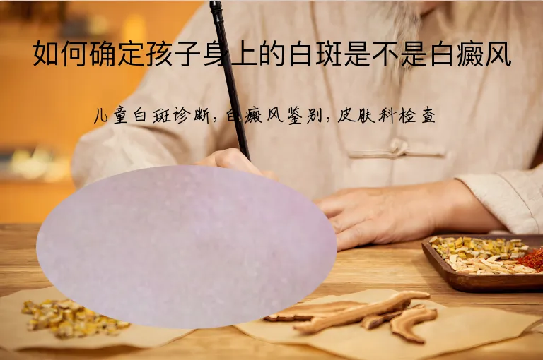 如何确定孩子身上的白斑是不是白癜风