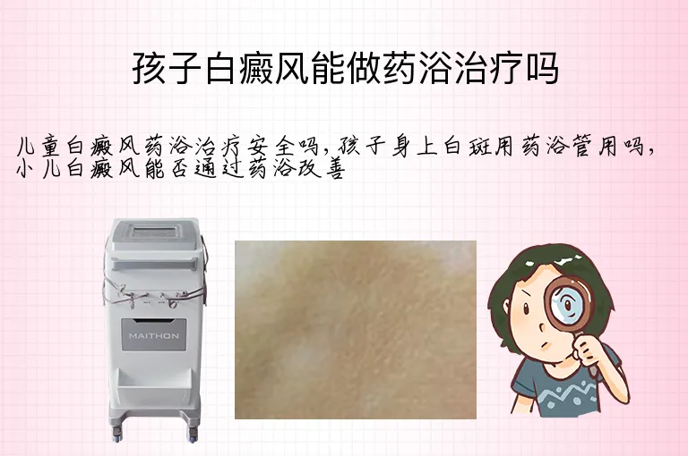 孩子白癜风能做药浴治疗吗
