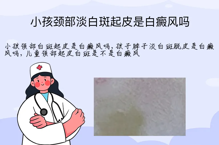 小孩颈部淡白斑起皮是白癜风吗