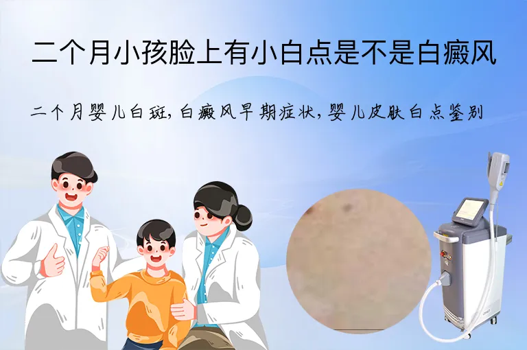 二个月小孩脸上有小白点是不是白癜风