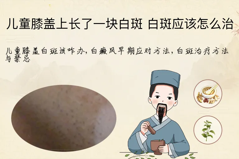 儿童膝盖上长了一块白斑 白斑应该怎么治