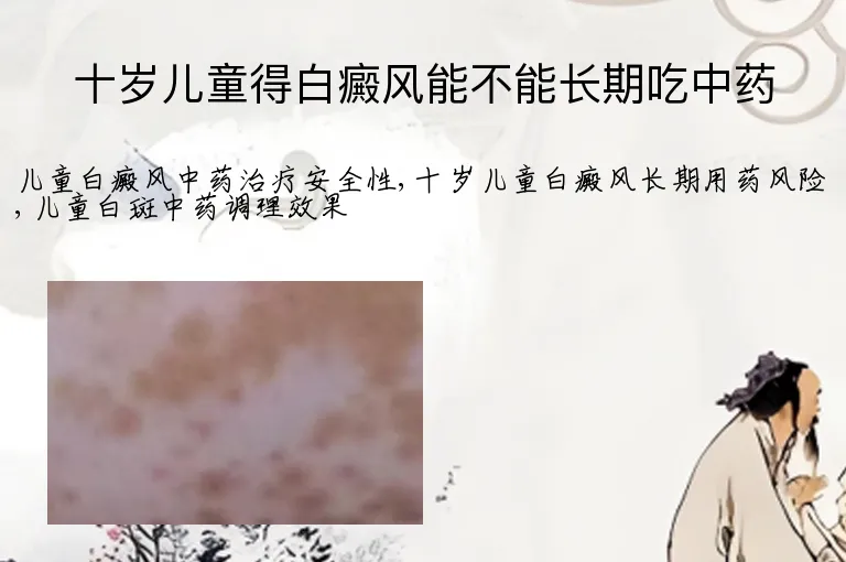 十岁儿童得白癜风能不能长期吃中药