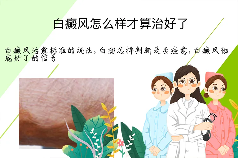 白癜风怎么样才算治好了
