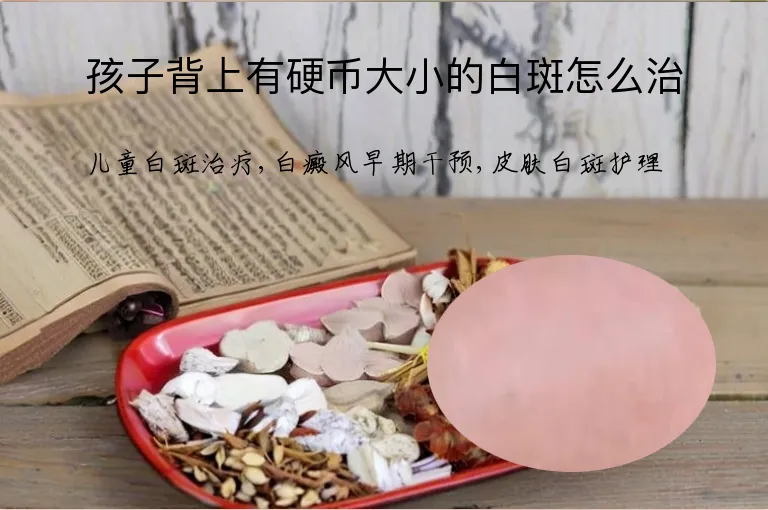 孩子背上有硬币大小的白斑怎么治