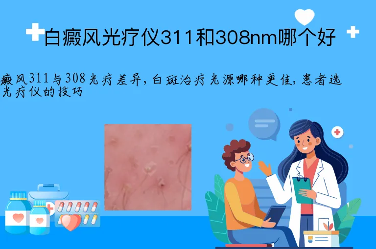 白癜风光疗仪311和308nm哪个好