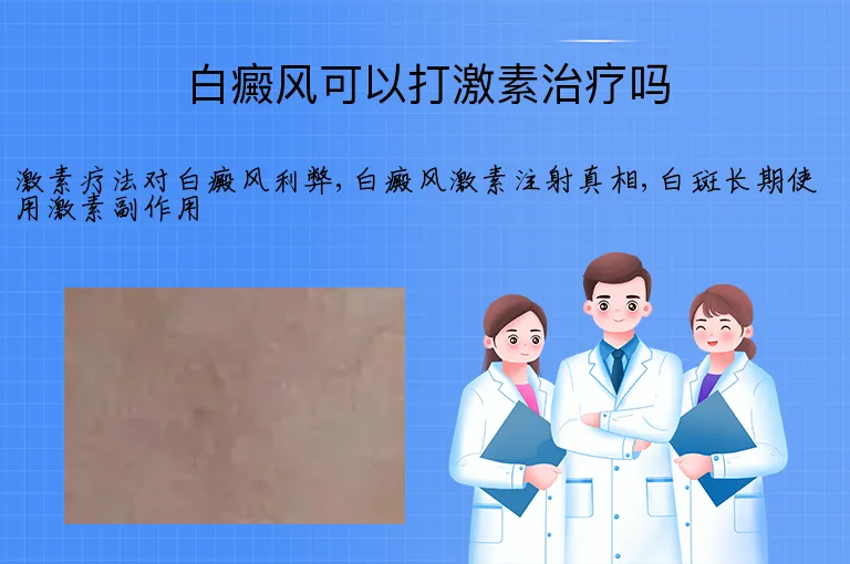 白癜风可以打激素治疗吗