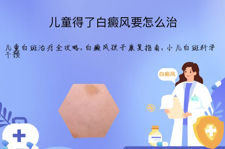 儿童得了白癜风要怎么治