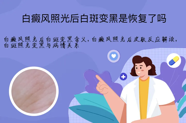 白癜风照光后白斑变黑是恢复了吗