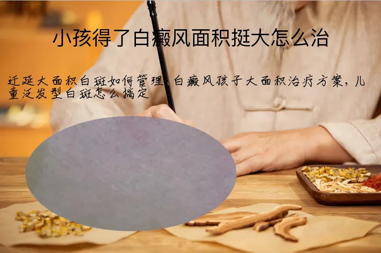 小孩得了白癜风面积挺大怎么治