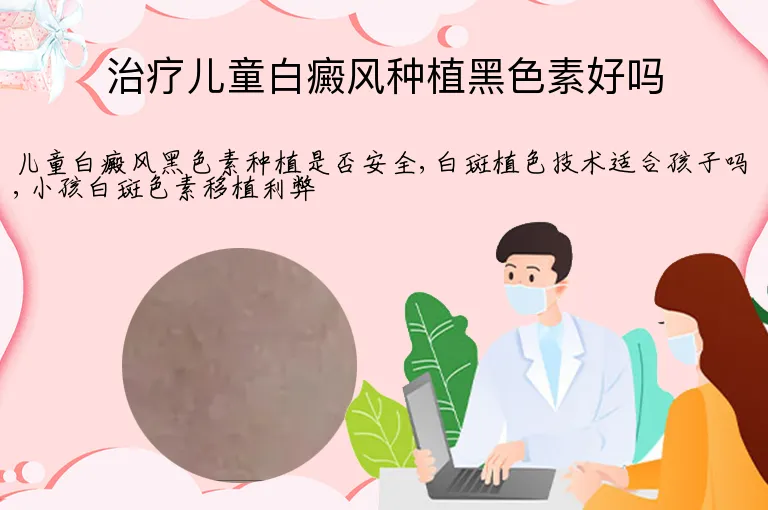 治疗儿童白癜风种植黑色素好吗