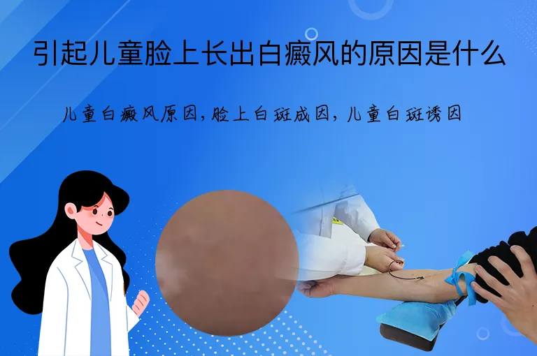 引起儿童脸上长出白癜风的原因是什么