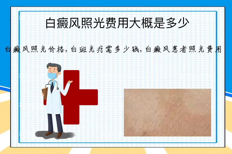 白癜风照光费用大概是多少