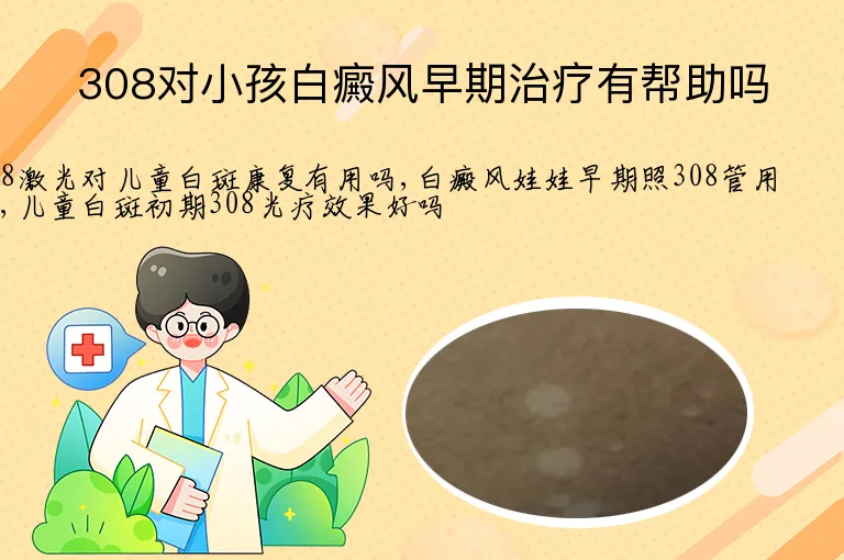 308对小孩白癜风早期治疗有帮助吗