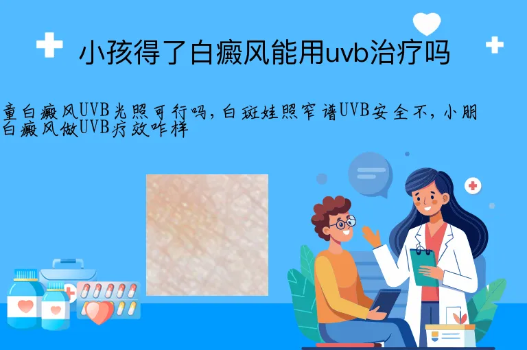 小孩得了白癜风能用uvb治疗吗