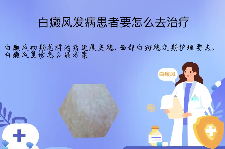 白癜风发病患者要怎么去治疗