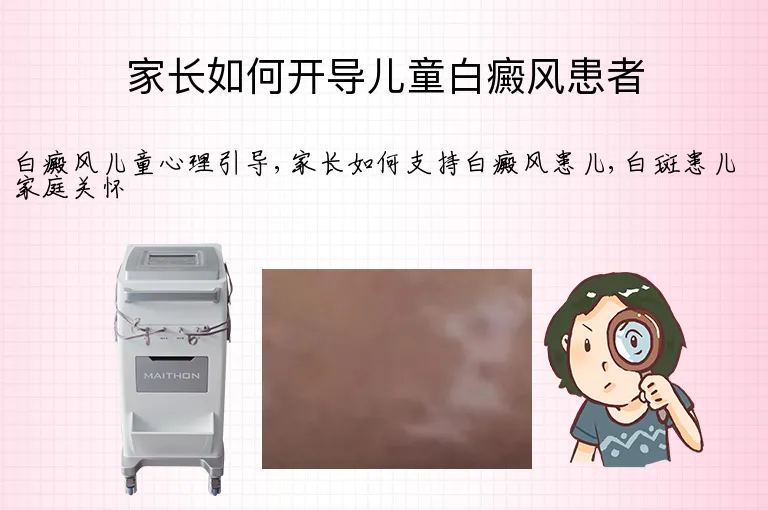 家长如何开导儿童白癜风患者